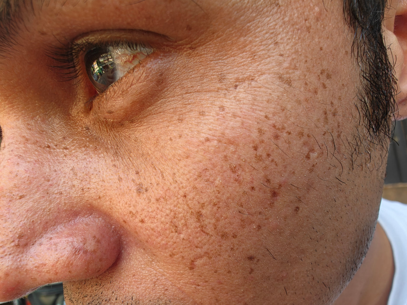 Before treatment